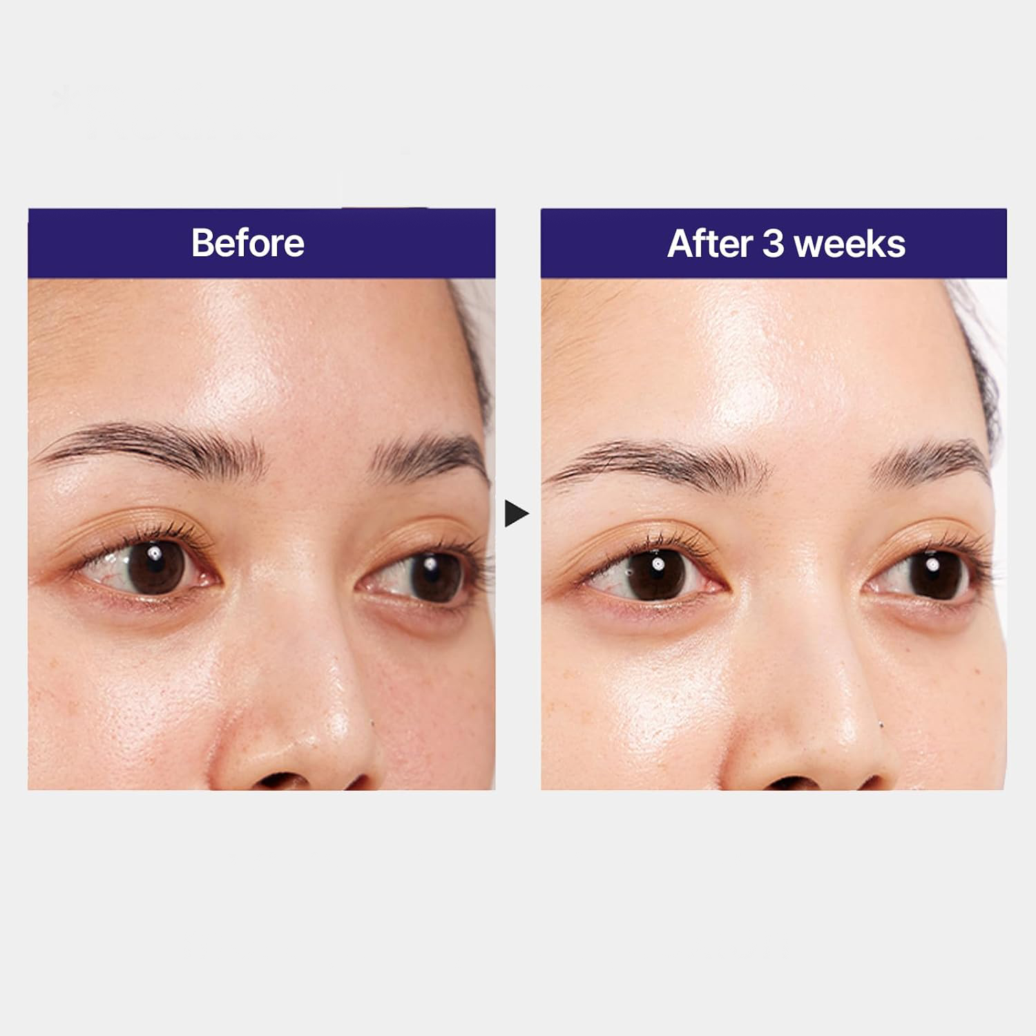 Anti-Aging Solutions